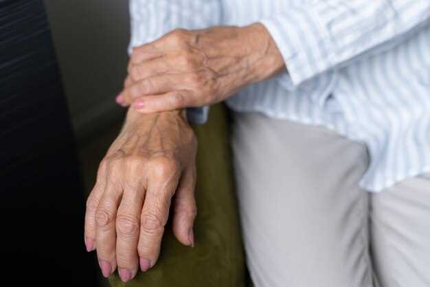 The Multifaceted Nature of Arthritis