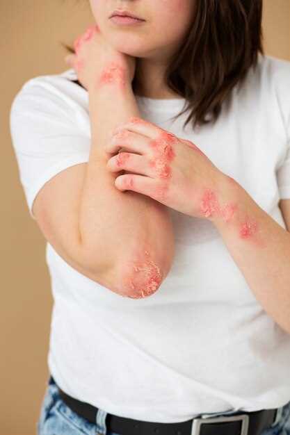 About Skin Irritation Caused by Medication